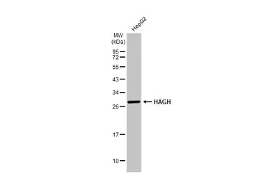 Anti-HAGH antibody [N2C3] used in Western Blot (WB). GTX105708