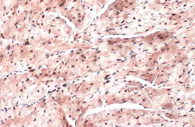 Anti-Nkx2.5 antibody used in IHC (Paraffin sections) (IHC-P). GTX105711