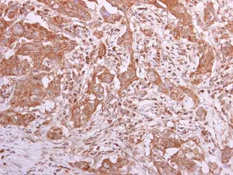 Anti-TCP1 theta antibody [N2C2], Internal used in IHC (Paraffin sections) (IHC-P). GTX105725