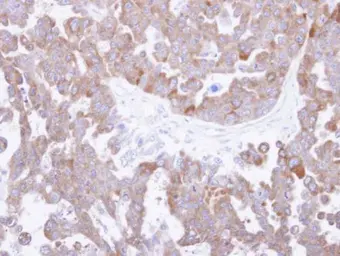 Anti-TCP1 theta antibody [N2C2], Internal used in IHC (Paraffin sections) (IHC-P). GTX105725