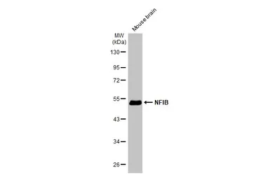 Anti-NFIB antibody [N1C2] used in Western Blot (WB). GTX105749