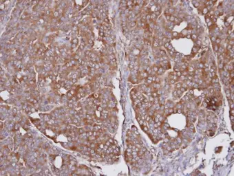Anti-SEC31A antibody [N1N3] used in IHC (Paraffin sections) (IHC-P). GTX105784