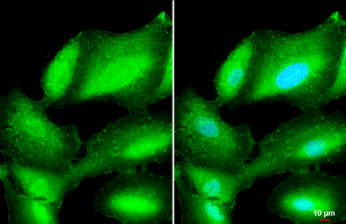 Anti-L-Plastin antibody used in Immunocytochemistry/ Immunofluorescence (ICC/IF). GTX105789