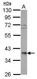Anti-POLR3F antibody used in Western Blot (WB). GTX105818