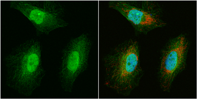 Anti-WBSCR22 antibody used in Immunocytochemistry/ Immunofluorescence (ICC/IF). GTX105840