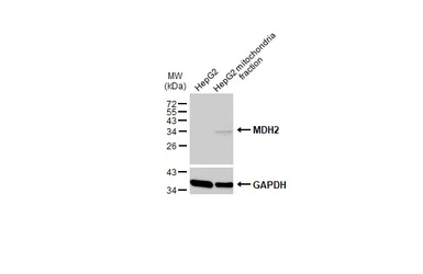 Anti-MDH2 antibody used in Western Blot (WB). GTX105870