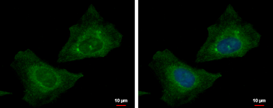 Anti-RABGGTB antibody used in Immunocytochemistry/ Immunofluorescence (ICC/IF). GTX105874