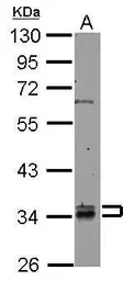 Anti-RABGGTB antibody used in Western Blot (WB). GTX105874