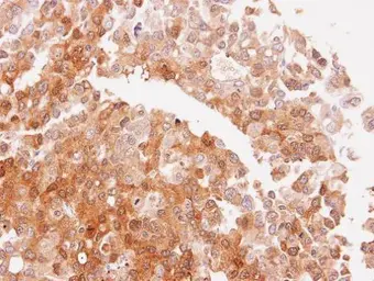 Anti-NQO2 antibody used in IHC (Paraffin sections) (IHC-P). GTX105899