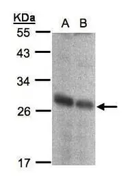 Anti-NQO2 antibody used in Western Blot (WB). GTX105899