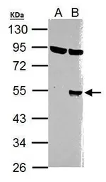 Anti-Wnt1 antibody used in Western Blot (WB). GTX105955