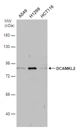 Anti-DCAMKL2 antibody [N2C2], Internal used in Western Blot (WB). GTX105963