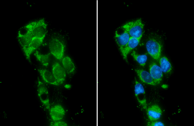 Anti-Monoamine Oxidase B antibody [N2C3] used in Immunocytochemistry/ Immunofluorescence (ICC/IF). GTX105970