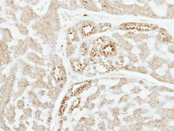 Anti-Factor XI antibody [N1N3] used in IHC (Paraffin sections) (IHC-P). GTX105974