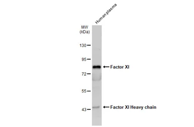 Anti-Factor XI antibody [N1N3] used in Western Blot (WB). GTX105974