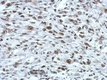 Anti-Rad21 antibody used in IHC (Paraffin sections) (IHC-P). GTX106012