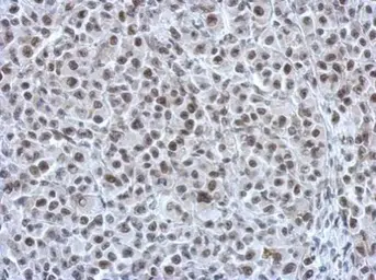 Anti-Rad21 antibody used in IHC (Paraffin sections) (IHC-P). GTX106012