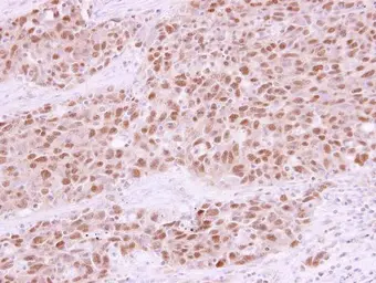 Anti-Rad21 antibody used in IHC (Paraffin sections) (IHC-P). GTX106012