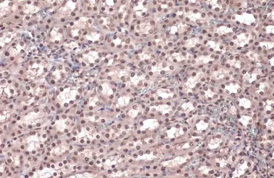 Anti-Rad21 antibody used in IHC (Paraffin sections) (IHC-P). GTX106012