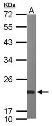 Anti-Sorcin antibody [N1C3] used in Western Blot (WB). GTX106105