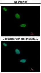 Anti-TLE2 antibody [C2C3], C-term used in Immunocytochemistry/ Immunofluorescence (ICC/IF). GTX106107
