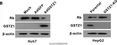 Anti-GSTZ1 antibody [N1C3] used in Western Blot (WB). GTX106109