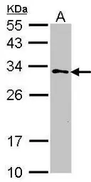 Anti-GSTZ1 antibody [N1C3] used in Western Blot (WB). GTX106109