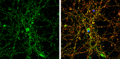 Anti-Glycine Receptor alpha 1 antibody [N1C1] used in Immunocytochemistry/ Immunofluorescence (ICC/IF). GTX106112
