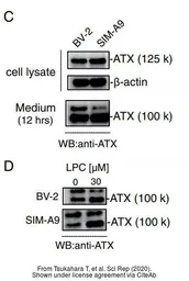 Anti-Autotaxin antibody used in Western Blot (WB). GTX106209