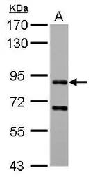 Anti-CD2AP antibody used in Western Blot (WB). GTX106235