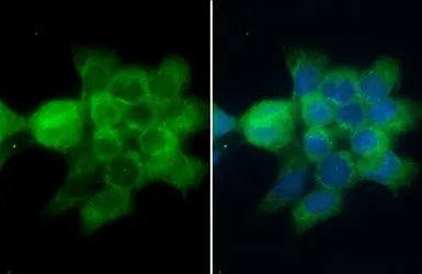 Anti-CD2AP antibody used in Immunocytochemistry/ Immunofluorescence (ICC/IF). GTX106235