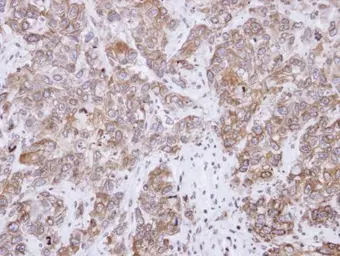 Anti-CD2AP antibody used in IHC (Paraffin sections) (IHC-P). GTX106235