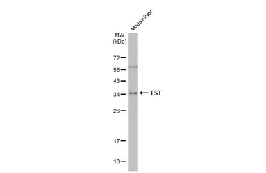 Anti-TST antibody used in Western Blot (WB). GTX106257