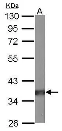 Anti-PP2A alpha antibody used in Western Blot (WB). GTX106334