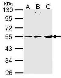 Anti-PDHX antibody [C3], C-term used in Western Blot (WB). GTX106352