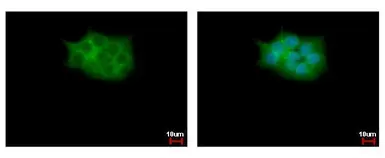 Anti-SCAP2 antibody [C2C3], C-term used in Immunocytochemistry/ Immunofluorescence (ICC/IF). GTX106357
