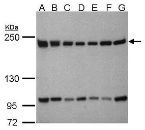 Anti-TAF172 antibody [C3], C-term used in Western Blot (WB). GTX106359