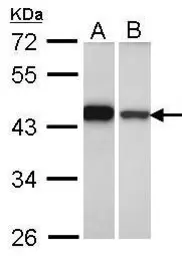 Anti-GIPC1 antibody used in Western Blot (WB). GTX106382