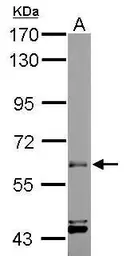 Anti-ARIH2 antibody [C3], C-term used in Western Blot (WB). GTX106404