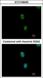 Anti-SAP130 antibody [C3], C-term used in Immunocytochemistry/ Immunofluorescence (ICC/IF). GTX106450