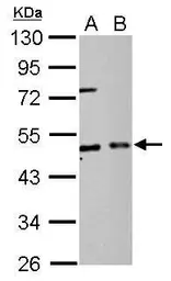 Anti-EIF2 beta antibody used in Western Blot (WB). GTX106484