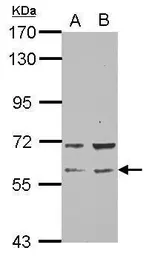 Anti-RAP1GDS1 antibody [N1N2], N-term used in Western Blot (WB). GTX106506