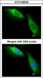 Anti-EEF1B2 antibody [N1C3] used in Immunocytochemistry/ Immunofluorescence (ICC/IF). GTX106535