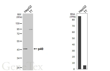 Anti-p40 antibody [N3C3] used in Western Blot (WB). GTX106557
