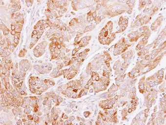 Anti-PEF1 antibody [N2C3] used in IHC (Paraffin sections) (IHC-P). GTX106588