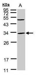 Anti-PEF1 antibody [N2C3] used in Western Blot (WB). GTX106588