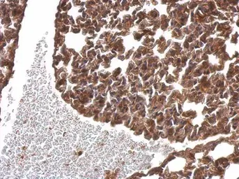 Anti-alpha SNAP antibody [N2C3] used in IHC (Paraffin sections) (IHC-P). GTX106626