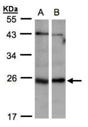 Anti-ITPase antibody [N1C3] used in Western Blot (WB). GTX106635