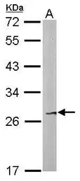 Anti-FAM122B antibody [N1C2] used in Western Blot (WB). GTX106678
