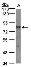 Anti-LIMD1 antibody [C2C3], C-term used in Western Blot (WB). GTX106685